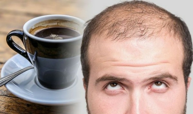 Kebiasaan Minum Kopi Bisa Buat Rambut Rontok? Simak Penjelasannya